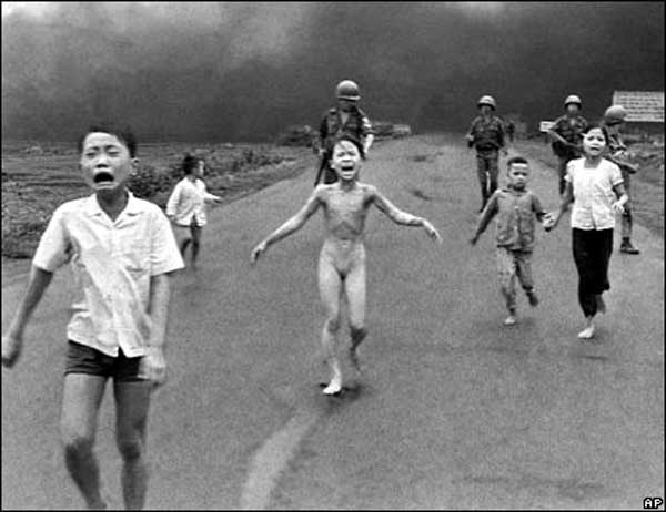 Kim Phuc burned by naipalm in vietnam